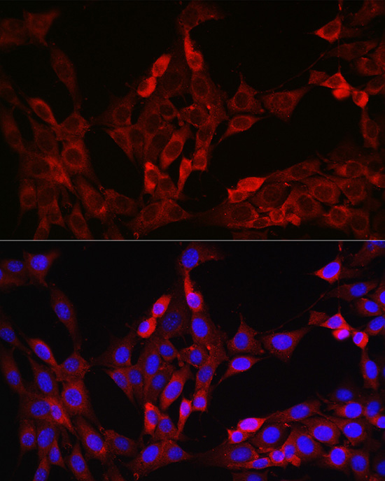 Immunofluorescence analysis of NIH/3T3 cells using FOXO4 Polyclonal Antibody at dilution of 1:100 (40x lens). Blue: DAPI for nuclear staining.