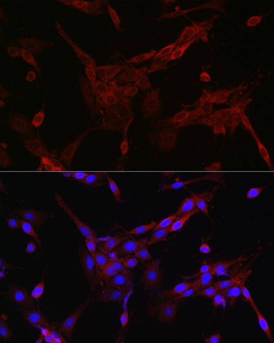 Immunofluorescence analysis of PC-12 cells using FOXO4 Polyclonal Antibody at dilution of 1:100 (40x lens). Blue: DAPI for nuclear staining.