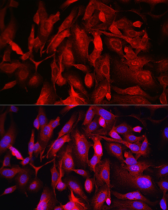 Immunofluorescence analysis of U2OS cells using FOXO4 Polyclonal Antibody at dilution of 1:100 (40x lens). Blue: DAPI for nuclear staining.