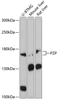 Western blot analysis of extracts of various cell lines using PZP Polyclonal Antibody at 1:3000 dilution.