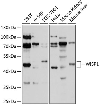 Western blot analysis of extracts of various cell lines using WISP1 Polyclonal Antibody at 1:1000 dilution.