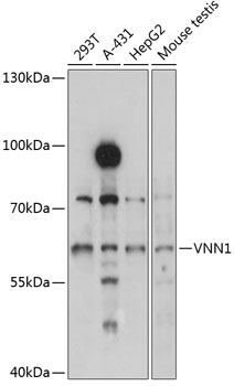 Western blot analysis of extracts of various cell lines using VNN1 Polyclonal Antibody at 1:3000 dilution.