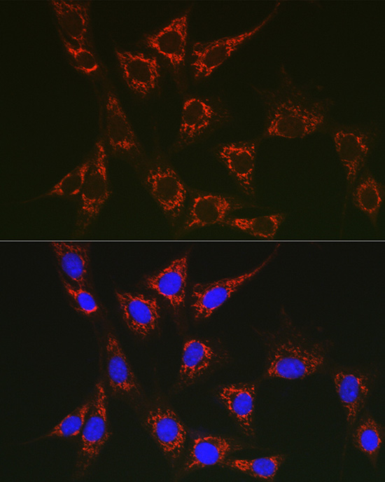 Immunofluorescence analysis of NIH/3T3 cells using SLC25A6 Polyclonal Antibody at dilution of 1:100 (40x lens). Blue: DAPI for nuclear staining.