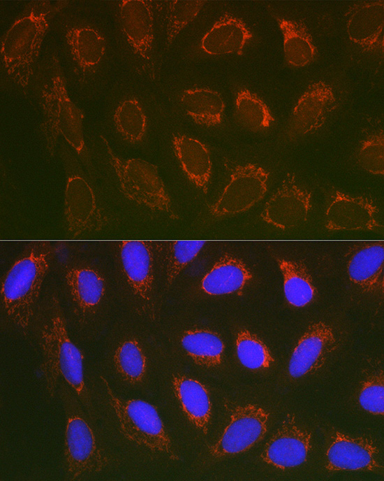 Immunofluorescence analysis of U2OS cells using SLC25A6 Polyclonal Antibody at dilution of 1:100 (40x lens). Blue: DAPI for nuclear staining.