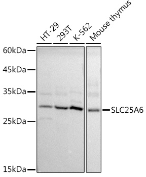 Western blot analysis of extracts of various cell lines using SLC25A6 Polyclonal Antibody at 1:1000 dilution.