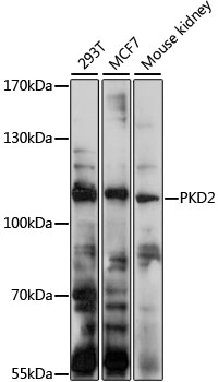 Western blot analysis of extracts of various cell lines using PKD2 Polyclonal Antibody at 1:1000 dilution.