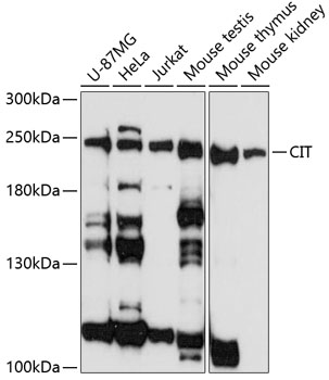 Western blot analysis of extracts of various cell lines using CIT Polyclonal Antibody at 1:3000 dilution.