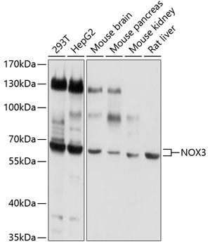 Western blot analysis of extracts of various cell lines using NOX3 Polyclonal Antibody at 1:1000 dilution.