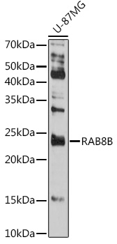 Western blot analysis of extracts of U-87MG cells using RAB8B Polyclonal Antibody at1:500 dilution.