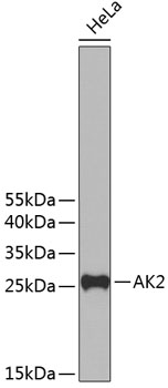 Western blot analysis of extracts of HeLa cells using AK2 Polyclonal Antibody