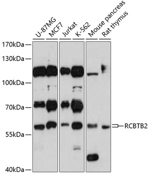 Western blot analysis of extracts of various cell lines using RCBTB2 Polyclonal Antibody at 1:3000 dilution.