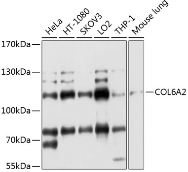 Western blot analysis of extracts of various cell lines using COL6A2 Polyclonal Antibody at 1:1000 dilution.