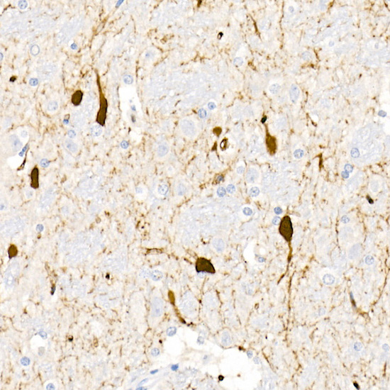 Immunohistochemistry of paraffin-embedded rat brain using DDC Polyclonal Antibody at dilution of 1:20 (40x lens).Perform high pressure antigen retrieval with 10 mM citrate buffer pH 6.0 before commencing with IHC staining protocol.