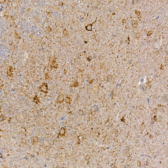 Immunohistochemistry of paraffin-embedded mouse brain using DVL3 Polyclonal Antibody at dilution of 1:100 (40x lens).Perform high pressure antigen retrieval with 10 mM citrate buffer pH 6.0 before commencing with IHC staining protocol.