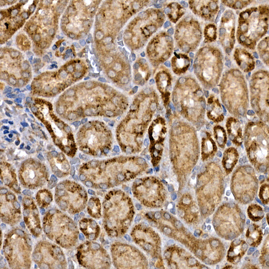 Immunohistochemistry of paraffin-embedded mouse kidney using DVL3 Polyclonal Antibody at dilution of 1:100 (40x lens).Perform high pressure antigen retrieval with 10 mM citrate buffer pH 6.0 before commencing with IHC staining protocol.