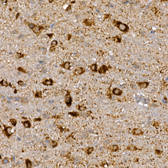 Immunohistochemistry of paraffin-embedded rat brain using DVL3 Polyclonal Antibody at dilution of 1:100 (40x lens).Perform high pressure antigen retrieval with 10 mM citrate buffer pH 6.0 before commencing with IHC staining protocol.