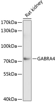 Western blot analysis of extracts of rat kidney using GABRA4 Polyclonal Antibody at 1:1000 dilution.