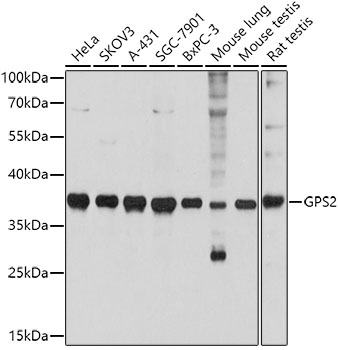 Western blot analysis of extracts of various cell lines using GPS2 Polyclonal Antibody at 1:3000 dilution.