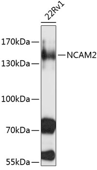 Western blot analysis of extracts of 22Rv1 cells using NCAM2 Polyclonal Antibody at 1:1000 dilution.