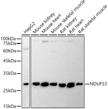 Western blot analysis of extracts of various cell lines using NDUFS3 Polyclonal Antibody antibody at 1:1000 dilution.