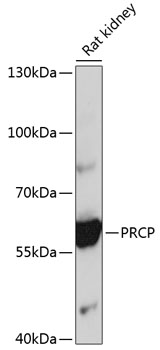 Western blot analysis of extracts of rat kidney using PRCP Polyclonal Antibody at 1:1000 dilution.