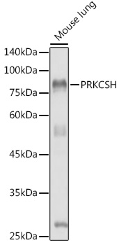 Western blot analysis of extracts of Mouse lung using PRKCSH Polyclonal Antibody at 1:1000 dilution.