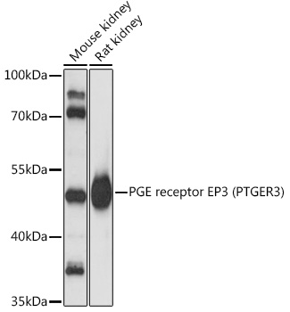 Western blot analysis of extracts of various cell lines using PGE receptor EP3 Polyclonal Antibody at1:3000 dilution.