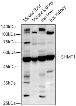 Western blot analysis of extracts of various cell lines using SHMT1 Polyclonal Antibody at 1:1500 dilution.