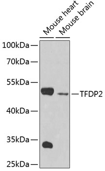 Western blot analysis of extracts of various cell lines using TFDP2 Polyclonal Antibody at 1:1000 dilution.