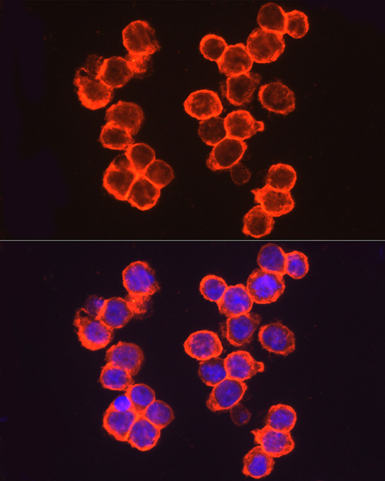 Immunofluorescence analysis of A-431 cells using CD141/Thrombomodulin Polyclonal Antibody at dilution of 1:100 (40x lens). Blue: DAPI for nuclear staining.