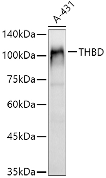 Western blot analysis of extracts of A-431 cells using CD141/Thrombomodulin Polyclonal Antibody at 1:1000 dilution.