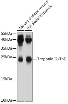 Western blot analysis of extracts of various cell lines using Troponin I1/TnI1 Polyclonal Antibody at 1:1000 dilution.