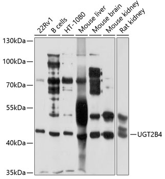 Western blot analysis of extracts of various cell lines using UGT2B4 Polyclonal Antibody at 1:1000 dilution.