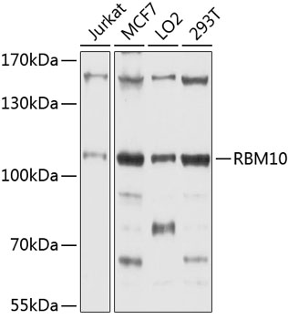 Western blot analysis of extracts of various cell lines using RBM10 Polyclonal Antibody at 1:1000 dilution.