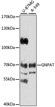 Western blot analysis of extracts of various cell lines using GNPAT Polyclonal Antibody at 1:1000 dilution.