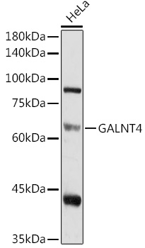 Western blot analysis of extracts of HeLa cells using GALNT4 Polyclonal Antibody at 1:1000 dilution.