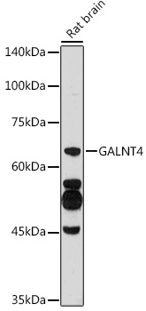 Western blot analysis of extracts of Rat brain using GALNT4 Polyclonal Antibody at 1:500 dilution.