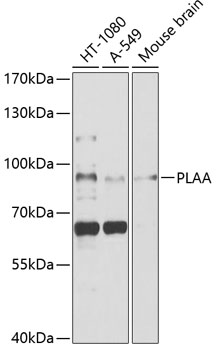 Western blot analysis of extracts of various cell lines using PLAA Polyclonal Antibody at 1:1000 dilution.
