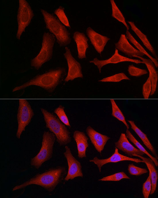 Immunofluorescence analysis of HeLa cells using PDIA4 Polyclonal Antibody at dilution of 1:50 (40x lens). Blue: DAPI for nuclear staining.