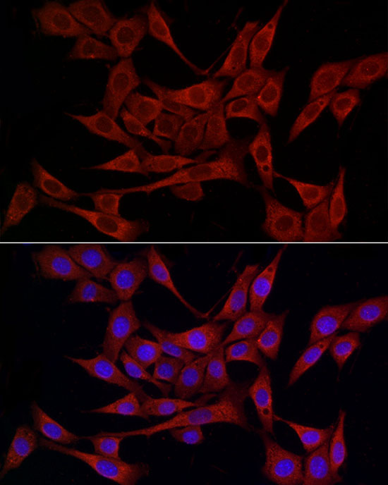 Immunofluorescence analysis of NIH/3T3 cells using PDIA4 Polyclonal Antibody at dilution of 1:50 (40x lens). Blue: DAPI for nuclear staining.