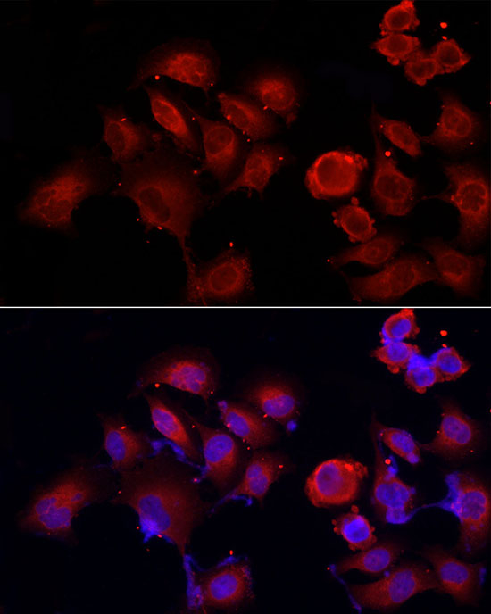 Immunofluorescence analysis of PC-3 cells using PDIA4 Polyclonal Antibody at dilution of 1:50 (40x lens). Blue: DAPI for nuclear staining.