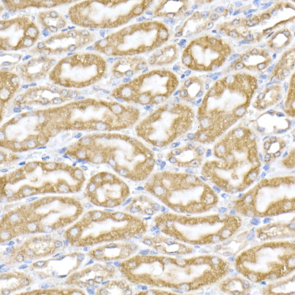 Immunohistochemistry of paraffin-embedded mouse kidney using PDIA4 Polyclonal Antibody at dilution of 1:50 (40x lens).Perform high pressure antigen retrieval with 10 mM citrate buffer pH 6.0 before commencing with IHC staining protocol.