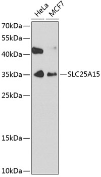 Western blot analysis of extracts of various cell lines using SLC25A15 Polyclonal Antibody at 1:1000 dilution.