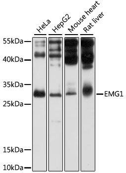 Western blot analysis of extracts of various cell lines using EMG1 Polyclonal Antibody at 1:1000 dilution.