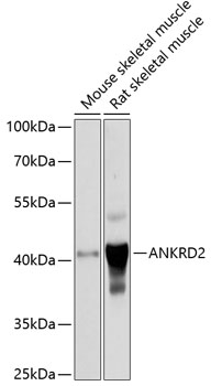 Western blot analysis of extracts of various cell lines using ANKRD2 Polyclonal Antibody at 1:1000 dilution.