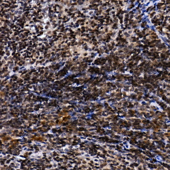 Immunohistochemistry of paraffin-embedded mouse spleen using NELFCD Polyclonal Antibody at dilution of 1:50 (40x lens).Perform high pressure antigen retrieval with 10 mM citrate buffer pH 6.0 before commencing with IHC staining protocol.