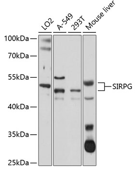 Western blot analysis of extracts of various cell lines using SIRPG Polyclonal Antibody at 1:1000 dilution.