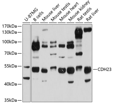 Western blot analysis of extracts of various cell lines using CDH23 Polyclonal Antibody at 1:1000 dilution.