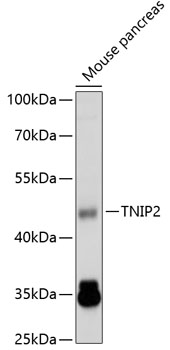 Western blot analysis of extracts of mouse pancreas using TNIP2 Polyclonal Antibody at 1:1000 dilution.