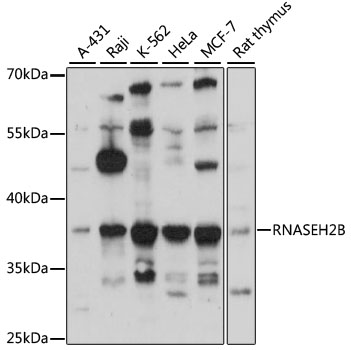 Western blot analysis of extracts of various cell lines using RNASEH2B Polyclonal Antibody at 1:3000 dilution.